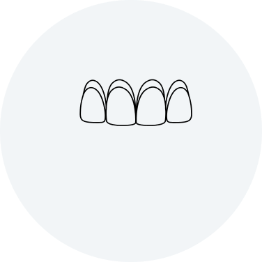 Outline of a dental bridge.