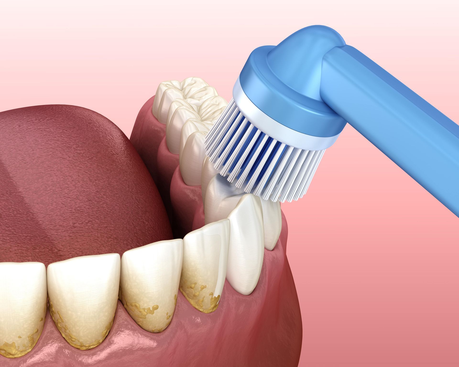 General Dentistry