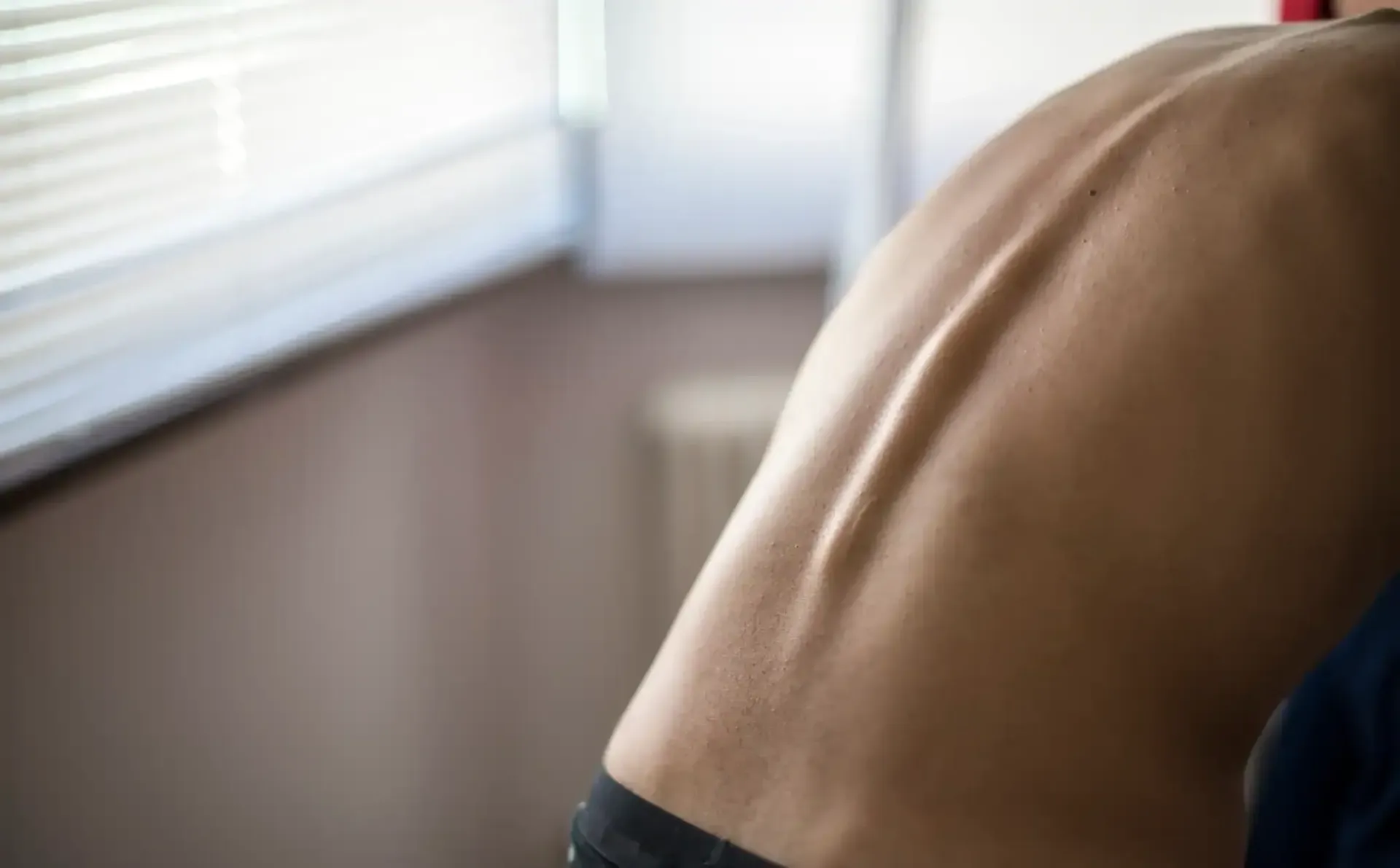 Close-up of a person’s bare back near a window with white blinds