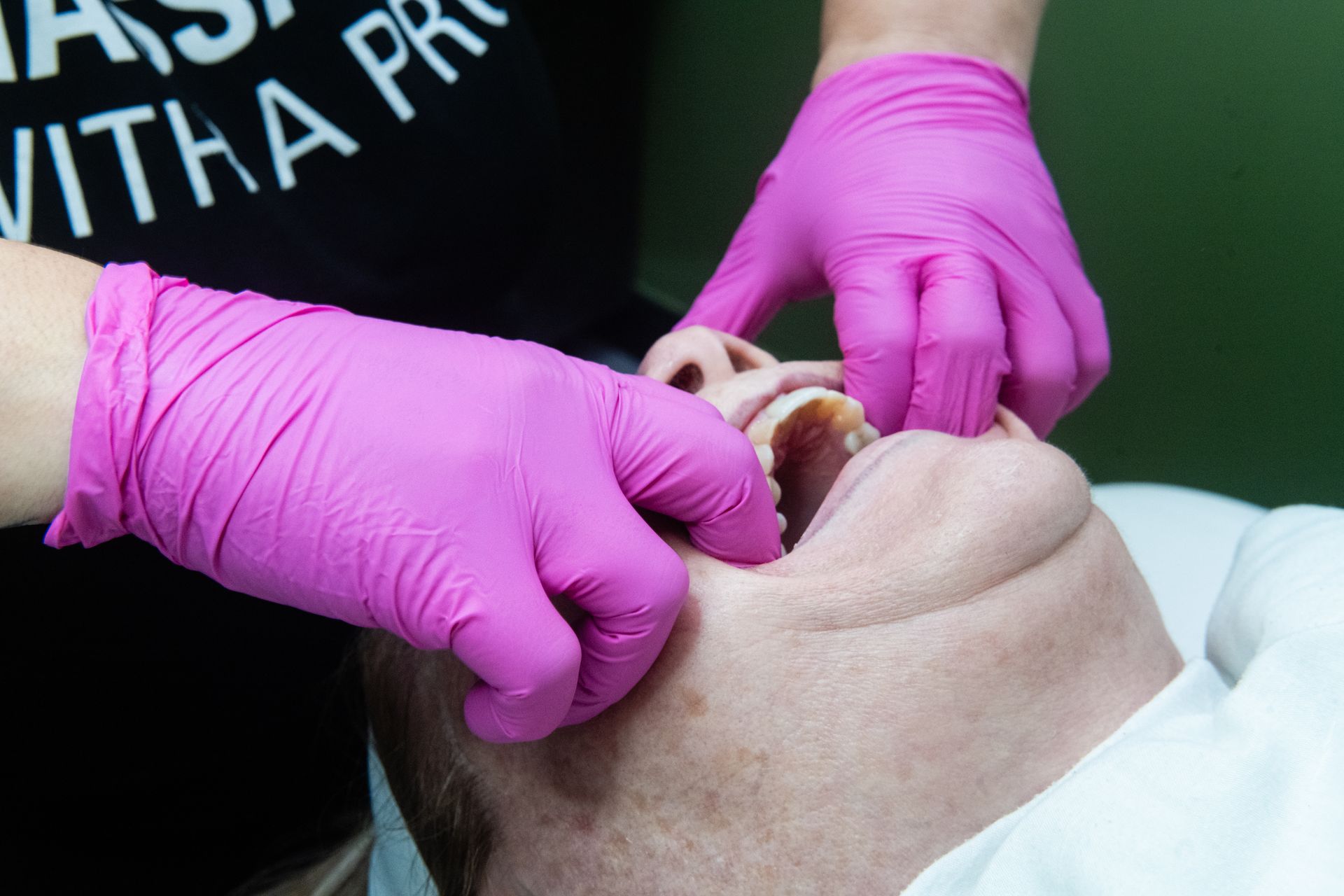 Buccal Massage casey healing wellness
