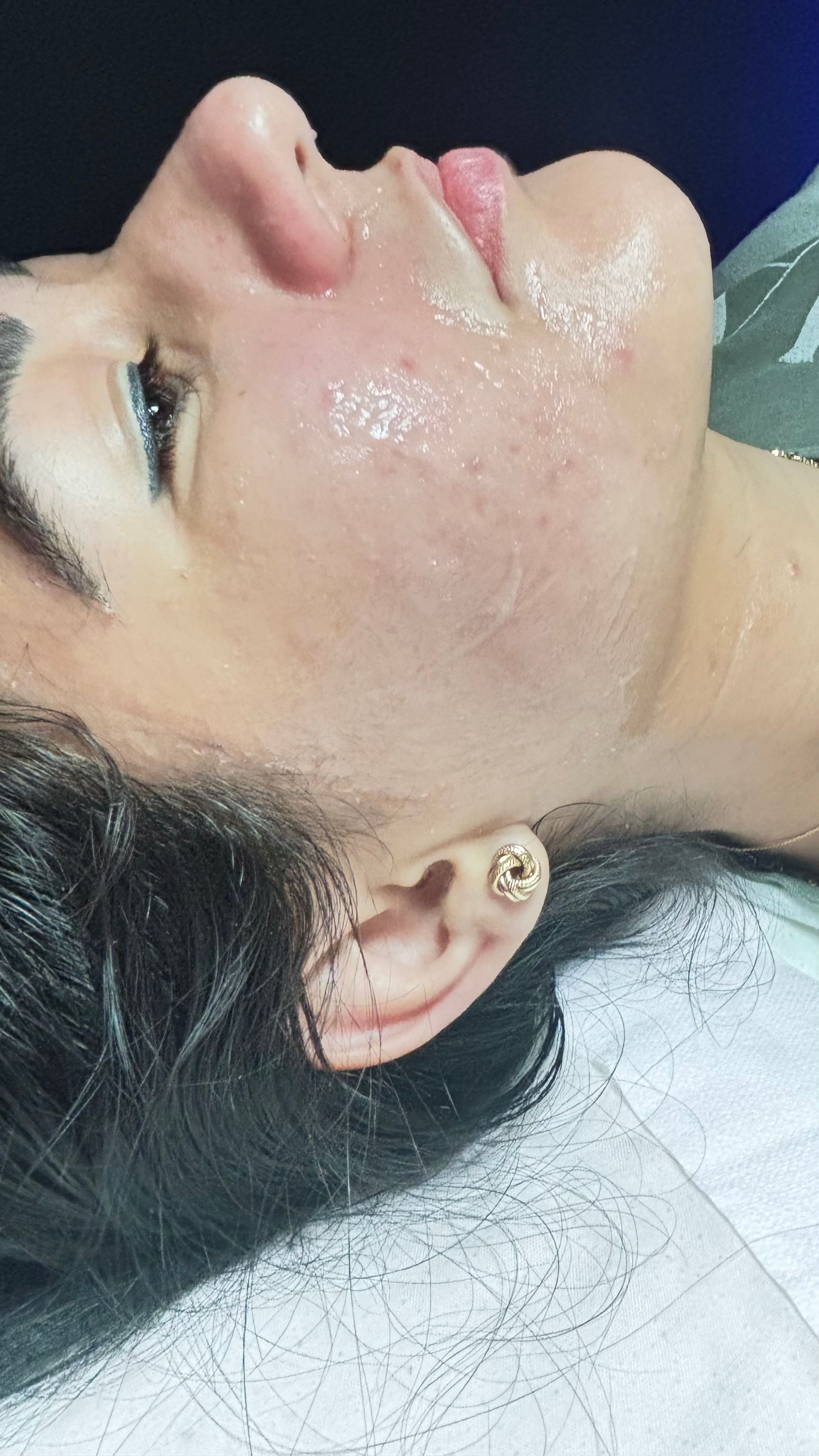 Person with skin care product on face; side profile casey healing wellness