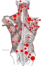 A drawing of a person 's back with red dots on it.