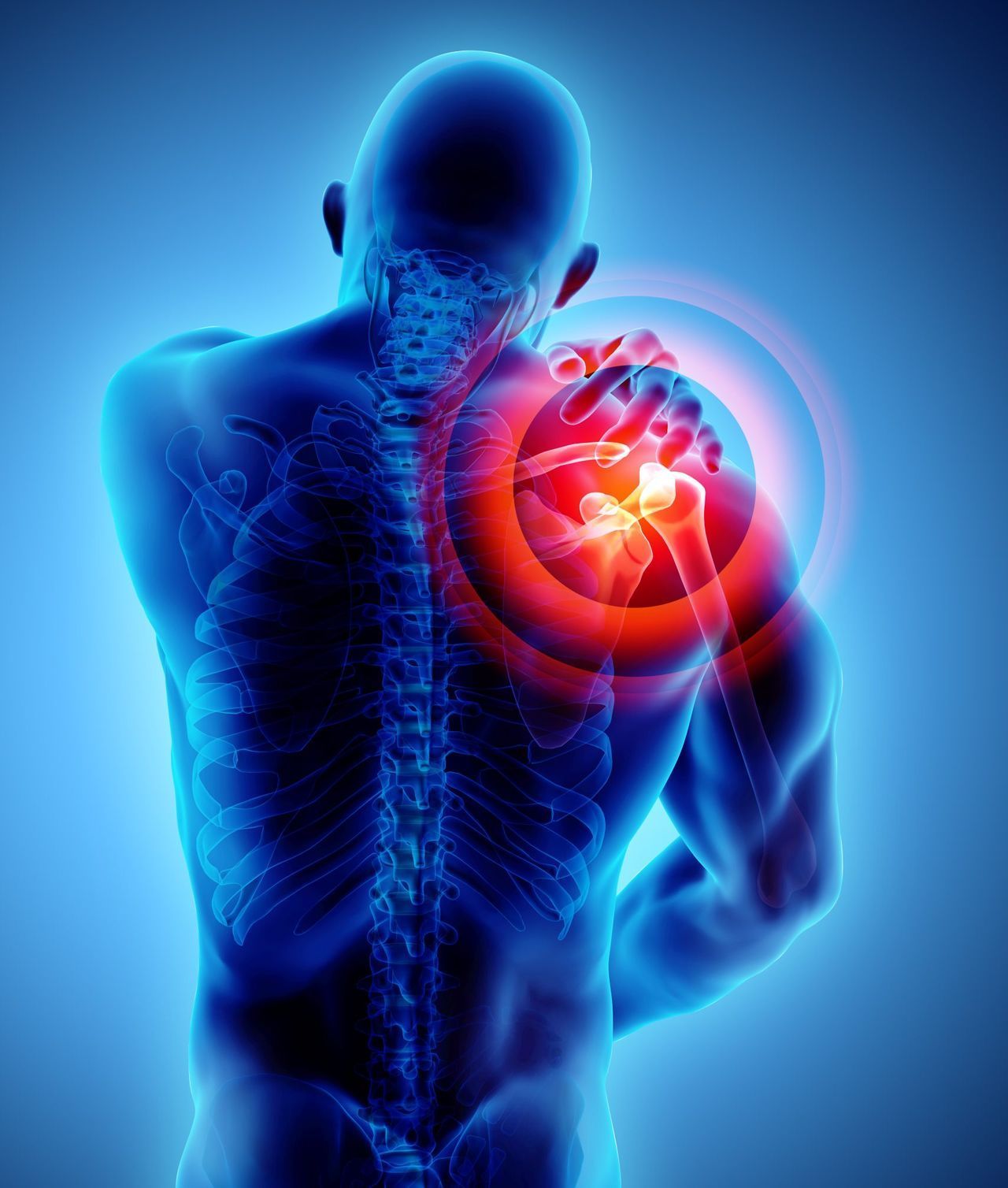 Human torso with a glowing red shoulder, indicating pain.