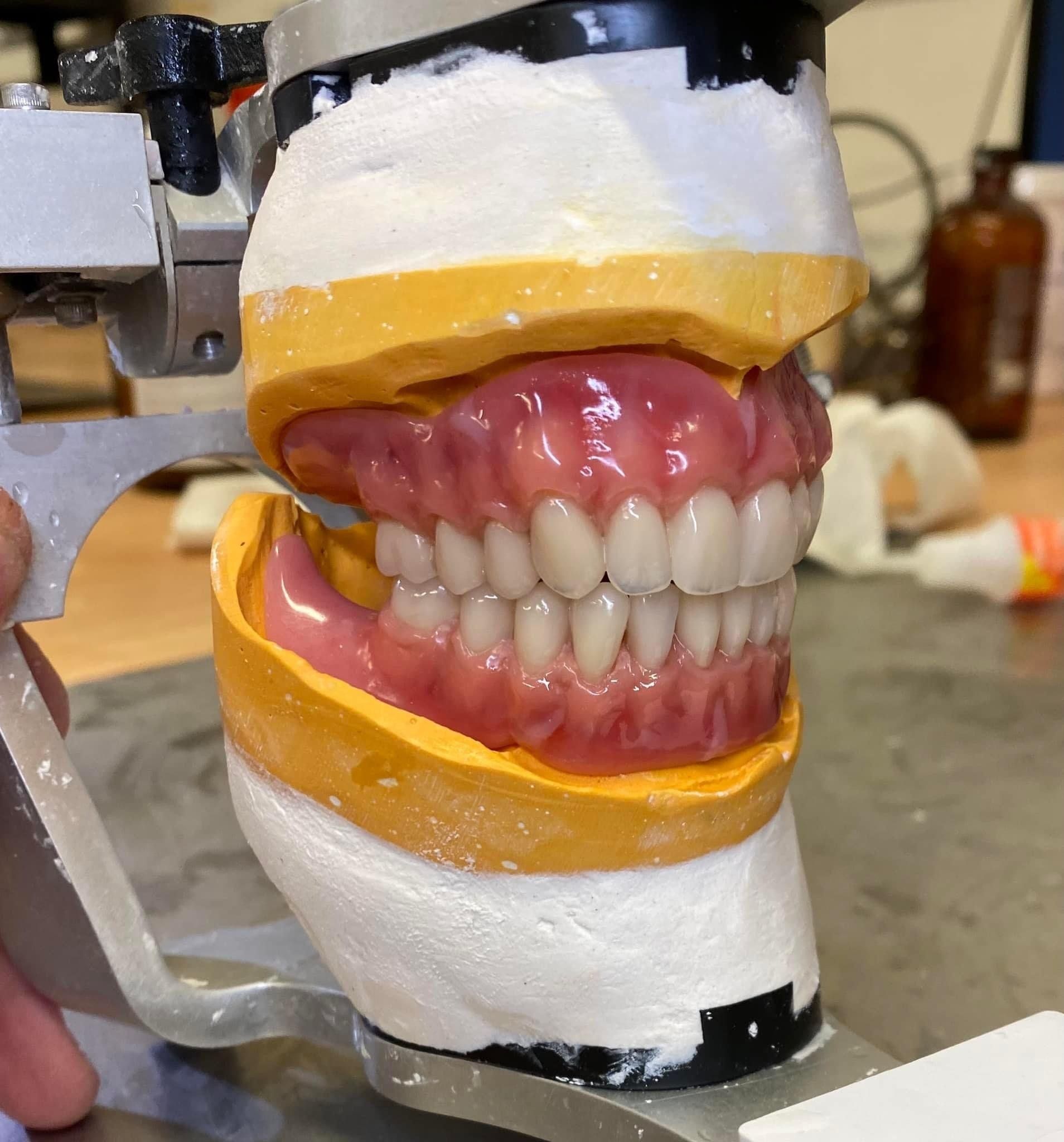 clean dentures up close