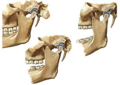 articolazioni temporo-mandibolari
