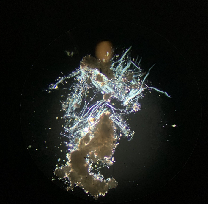 Microscopic view of organic material with long, thin, white filaments and a small, light-colored, round object.