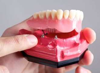 Hand holding dental model showing a denture attached to two implants. Pink gums, white teeth.