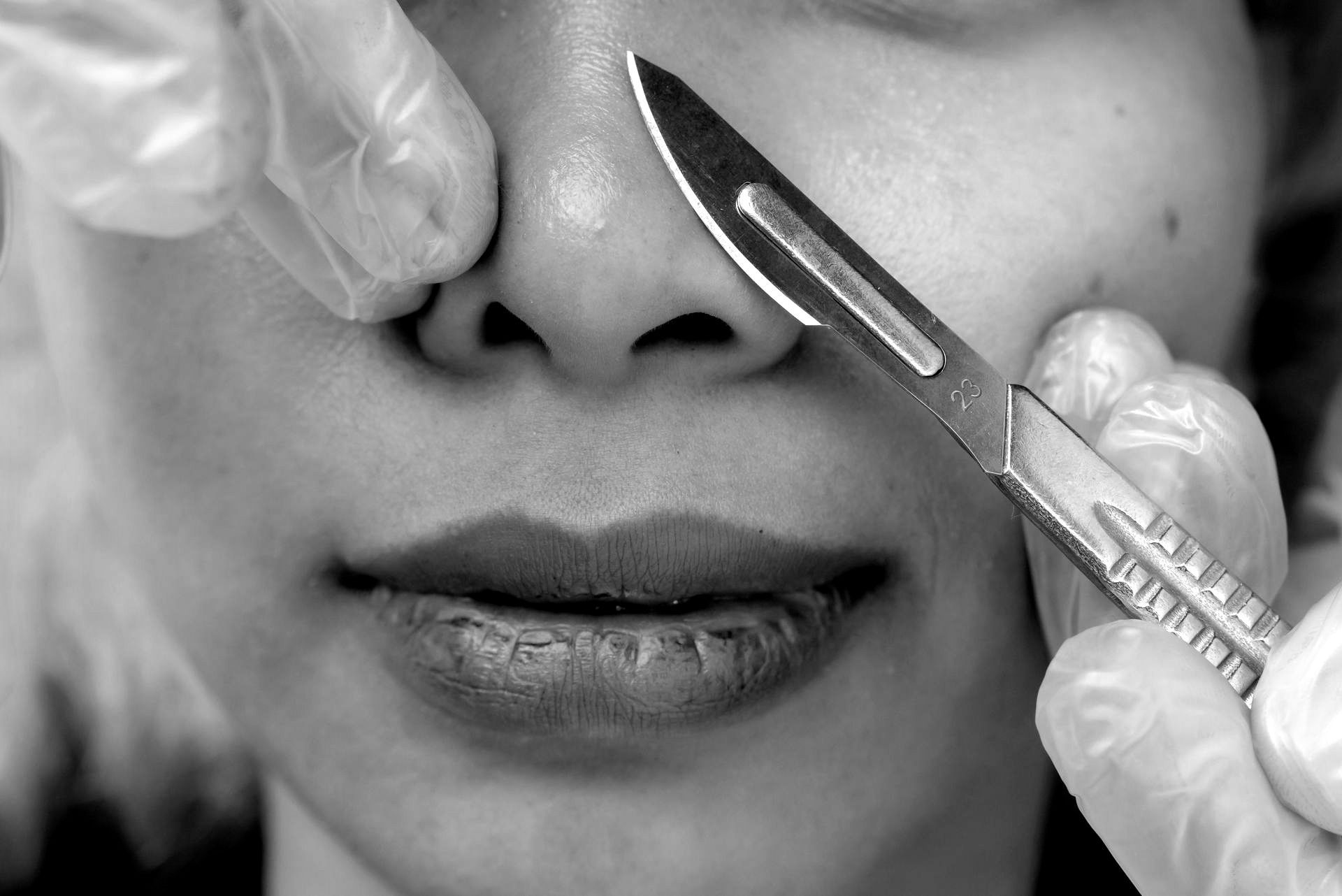 Facial Example