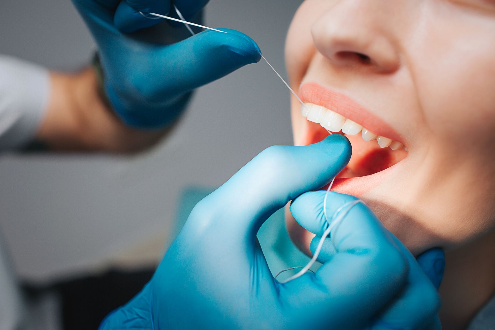 Dentist flossing a patient's teeth with blue-gloved hands in a close-up view.