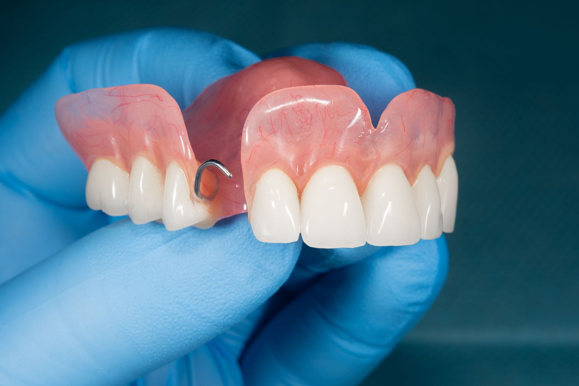 Hand in blue glove holding a partial dental plate with pink gum and white teeth.