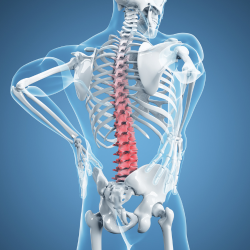 Person with herniated disc