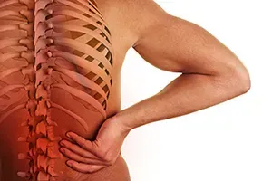 Person with a herniated disc