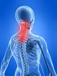 Neck Pain Skeleton Example