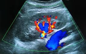 Vascular Studies — Fort Smith, AR — Arkansas Heart Center