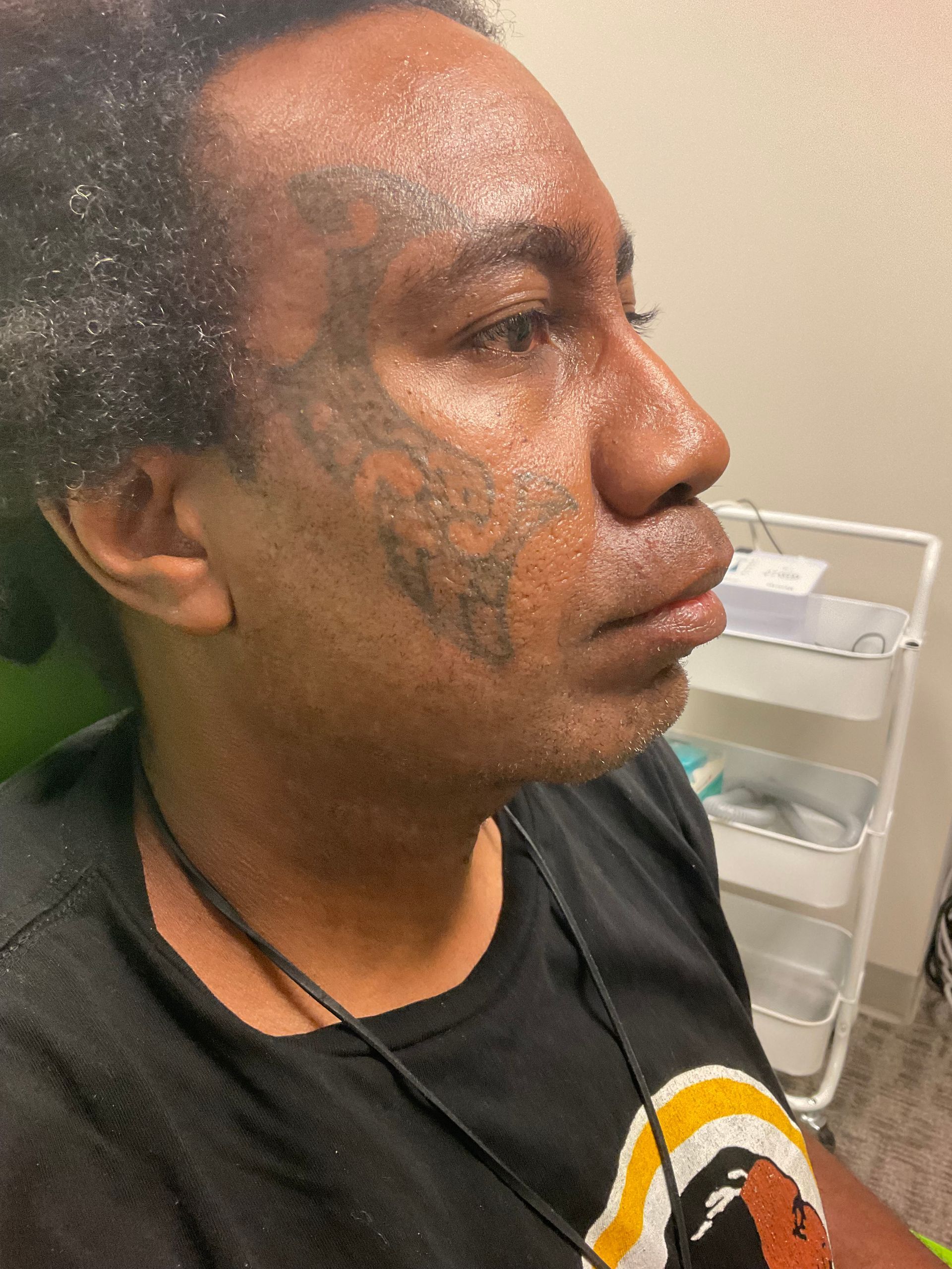 Person with facial tattoo, in a doctor's office. They are looking to the side, with a slight frown.