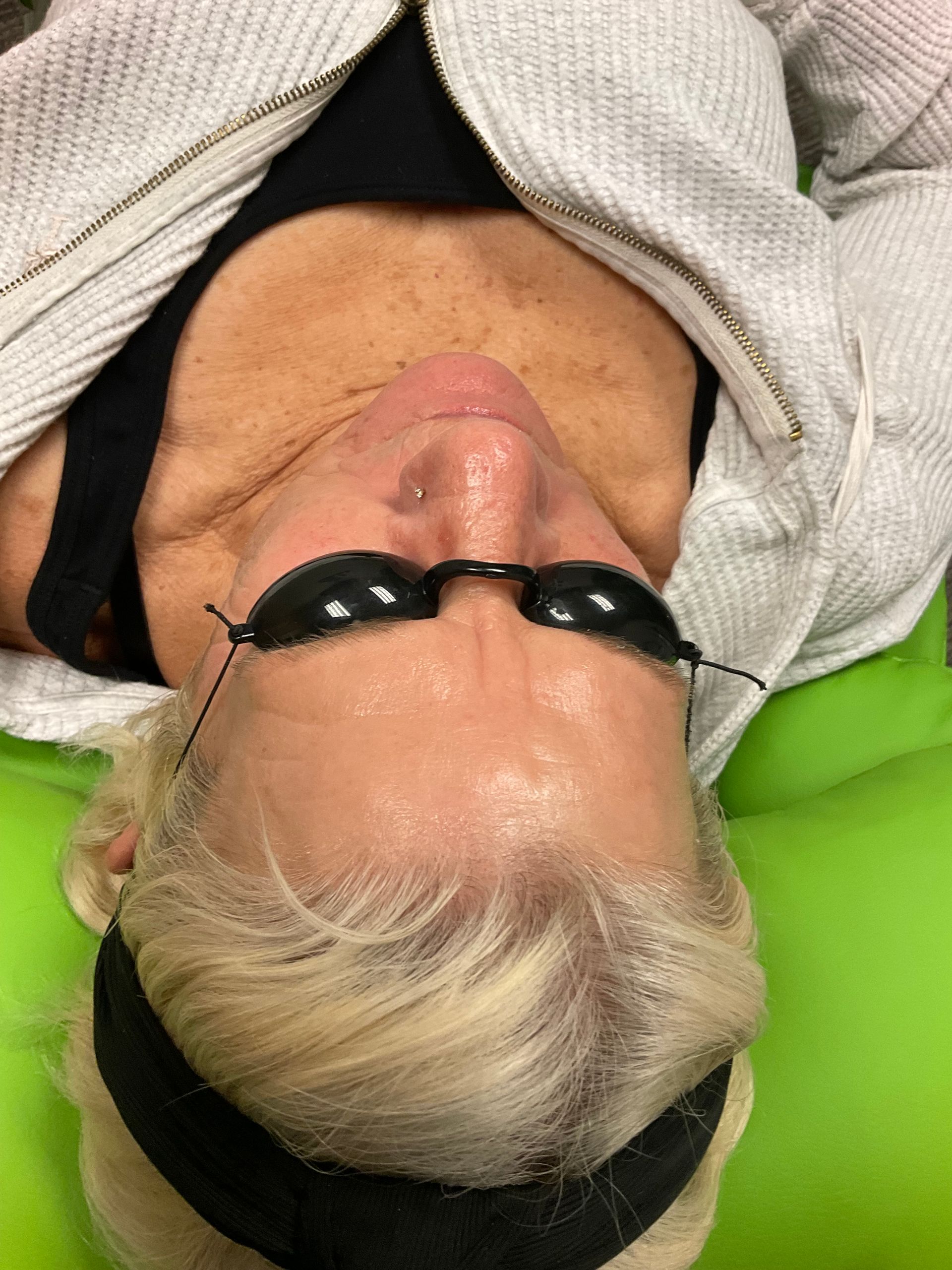 Person wearing eye protection and headband, lying down. Forehead is slightly shiny.