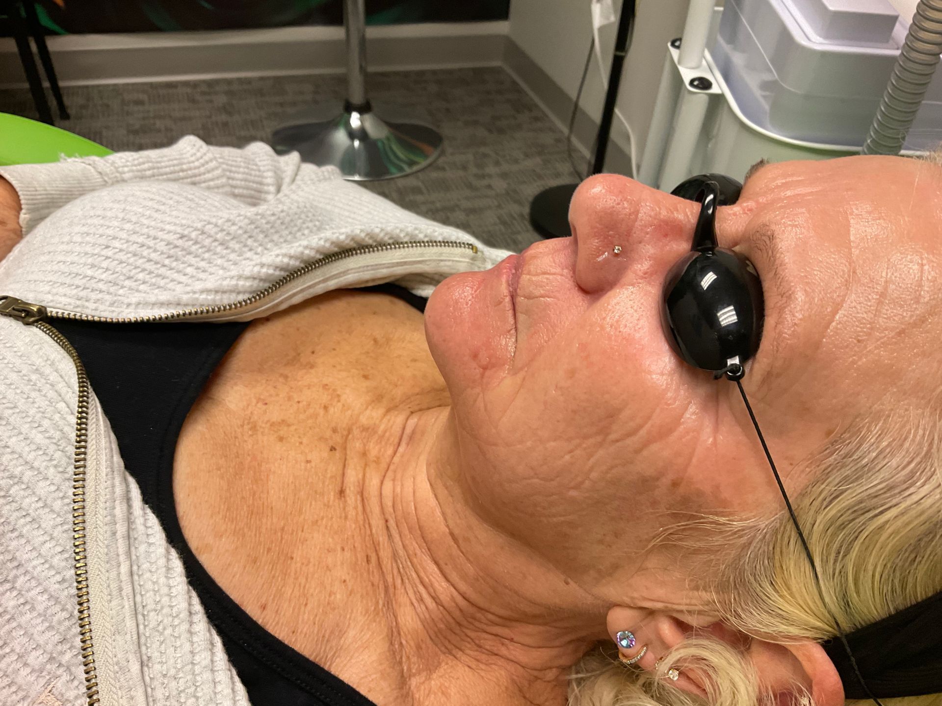 Person wearing eye protection during a skin treatment. They are lying down with wet skin.
