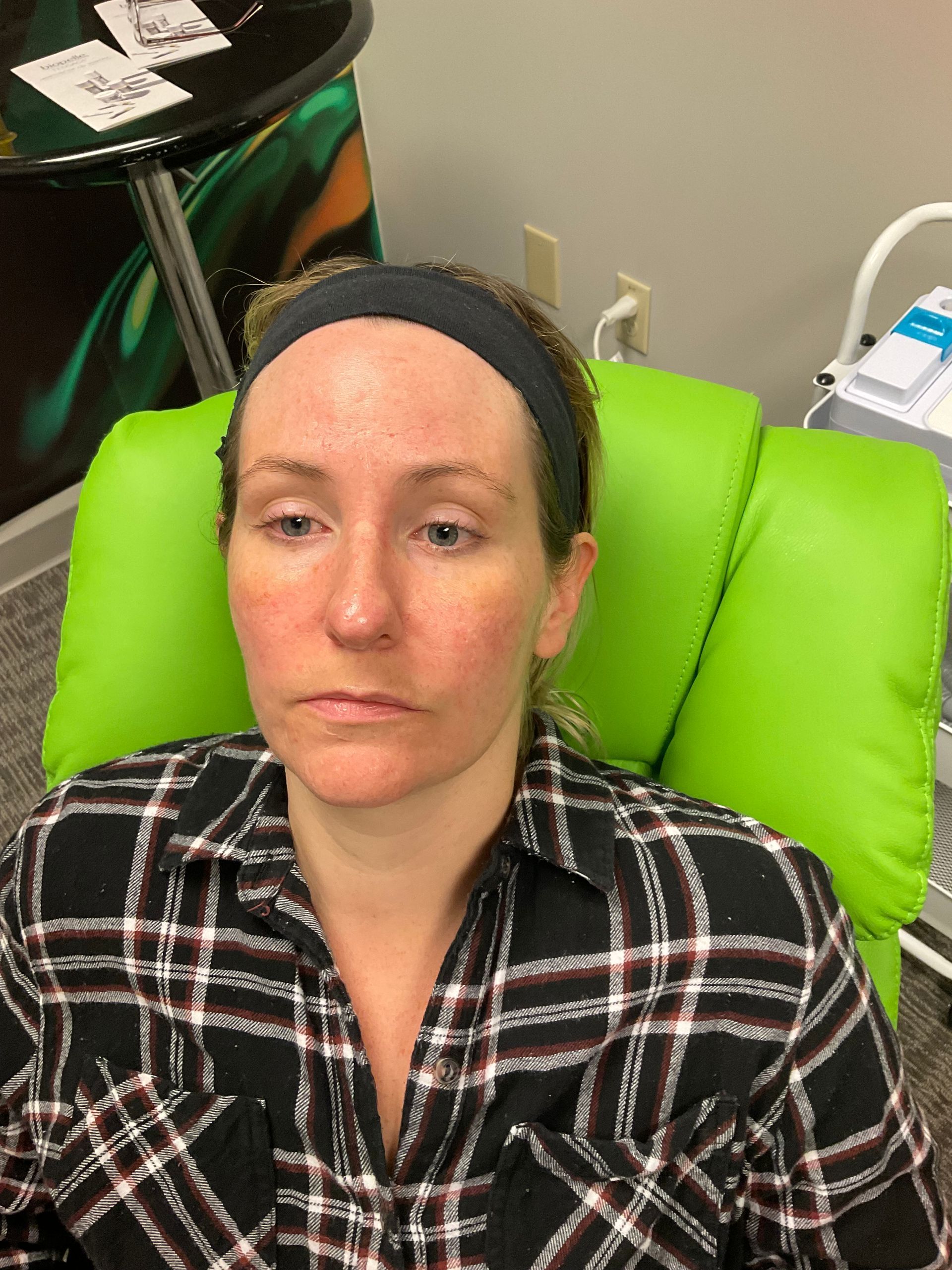 Woman in a plaid shirt sits in a green chair. She has a headband and flushed skin.