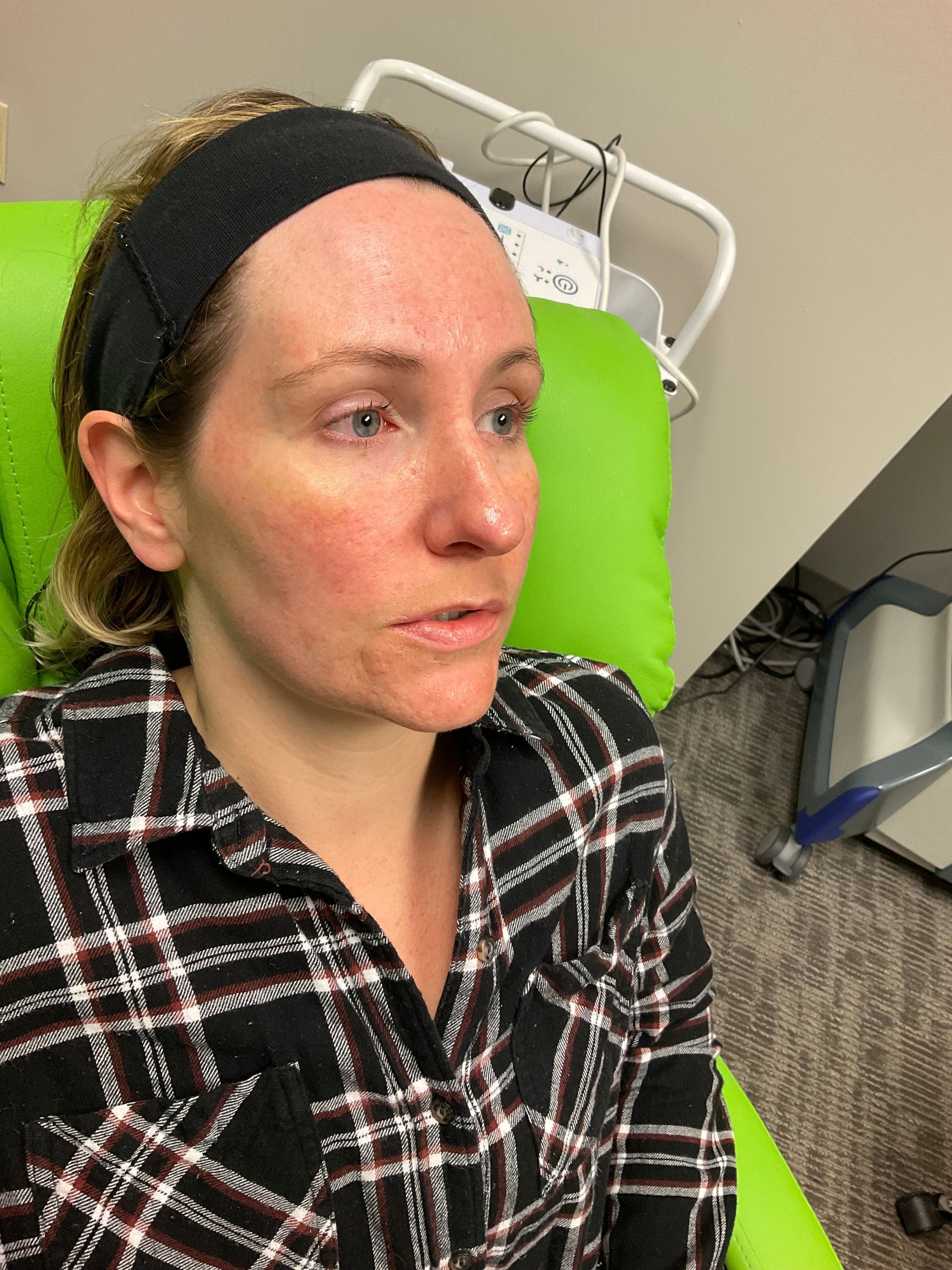 Woman with red skin, wearing a black headband and plaid shirt, in a medical setting.