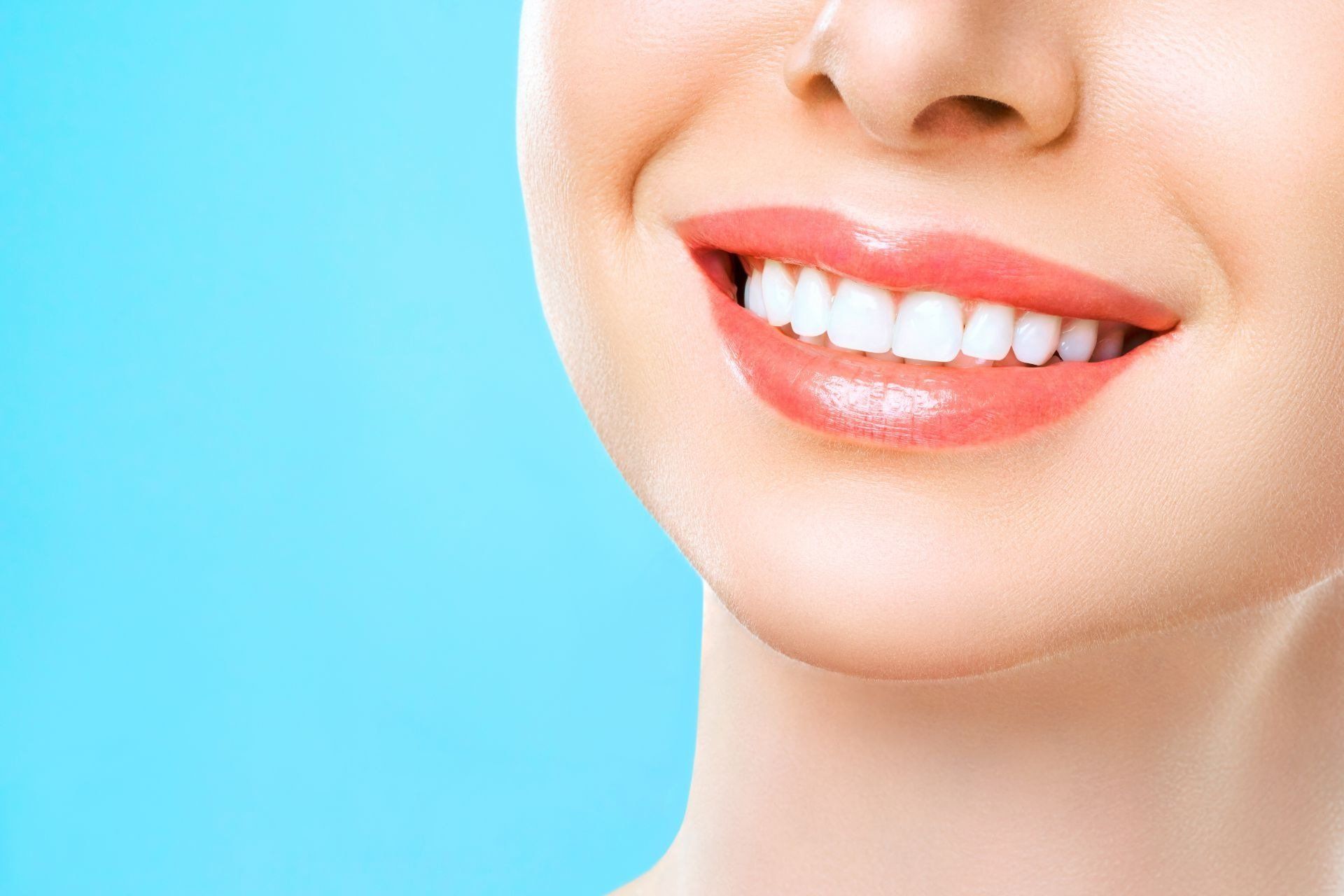 Faccette dentali