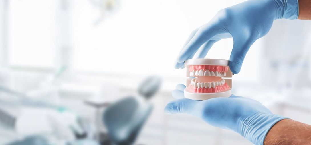 calco dentale