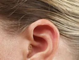 CIC — Prescott Valley, AZ — Clear Choice﻿ Hearing Solutions