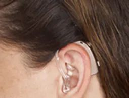 BTE With Earmold — Prescott Valley, AZ — Clear Choice﻿ Hearing Solutions
