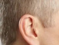 Mini BTE — Prescott Valley, AZ — Clear Choice﻿ Hearing Solutions