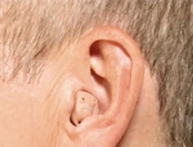 ITC or Half Shell — Prescott Valley, AZ — Clear Choice﻿ Hearing Solutions