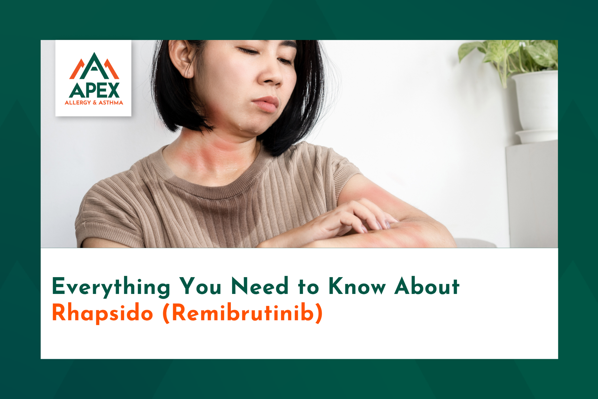 Without effective treatment, like remibrutinib for urticaria, a woman with chronic hives scratches h