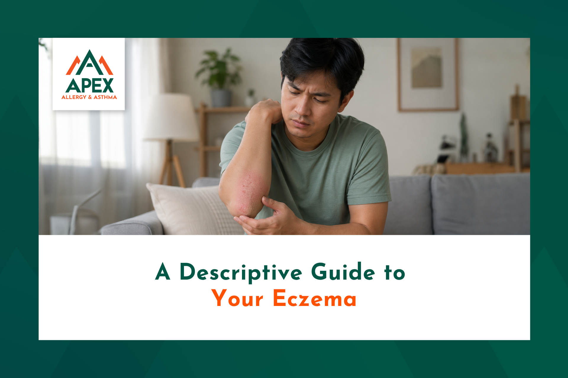 A man looking at his elbow, which has an eczema rash. He looks worried and lost, as if thinking abou