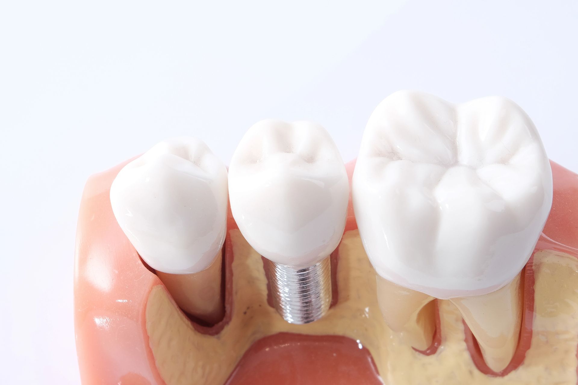 Un dentista con indosso guanti blu utilizza strumenti odontoiatrici per esaminare i denti di un paziente seduto su una poltrona.