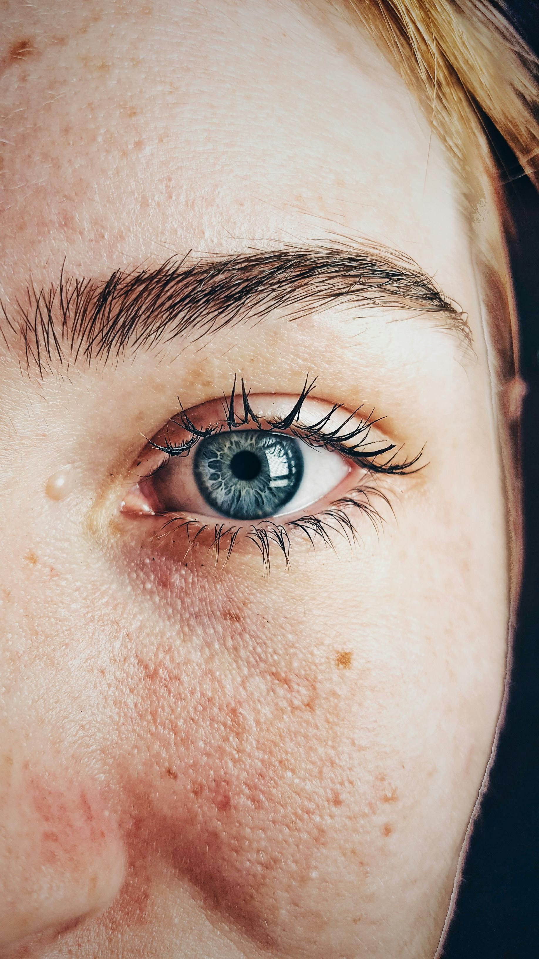 Um close do olho azul de uma mulher com sardas.
