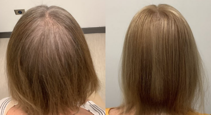 A before and after photo of a woman 's hair.
