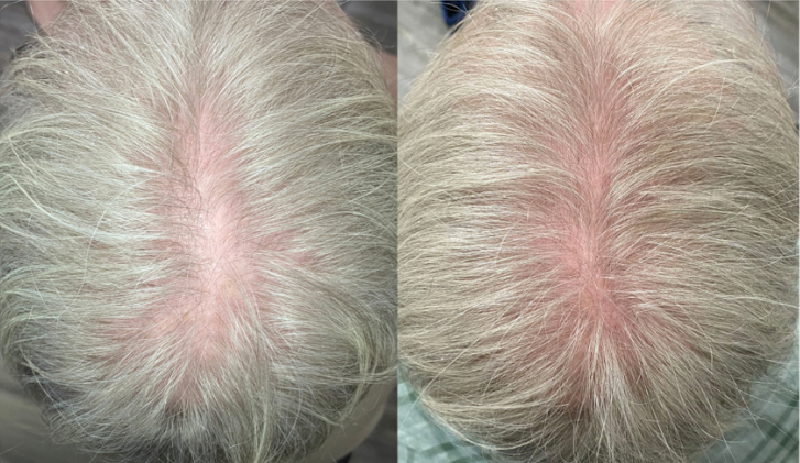 A before and after picture of a person 's hair.