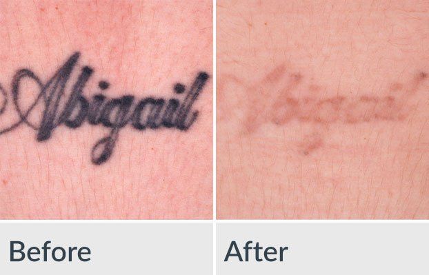 A before and after picture of a tattoo that says abigail
