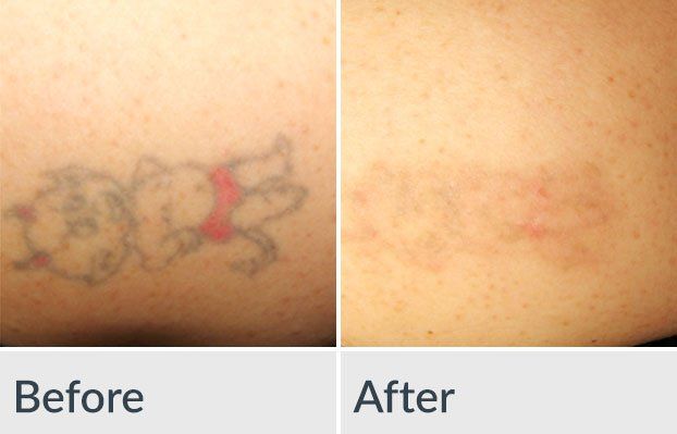 A before and after picture of a tattoo on a person 's back.
