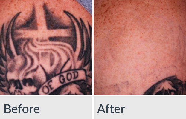 A before and after picture of a tattoo that says of god
