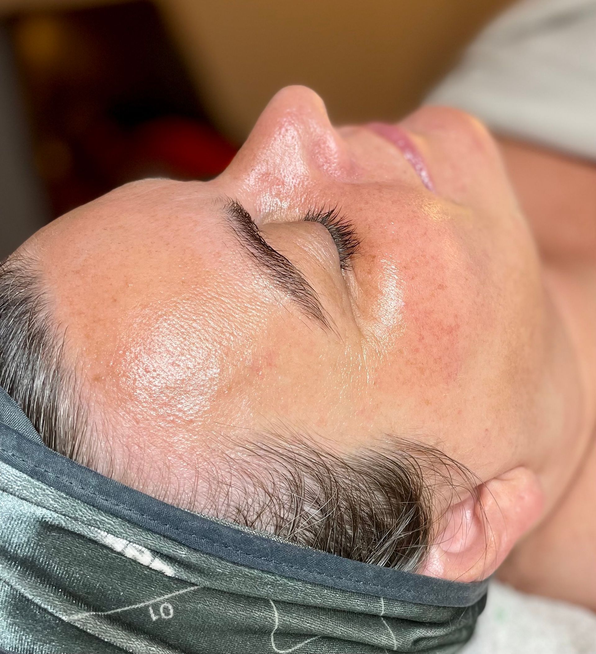 before & after facial