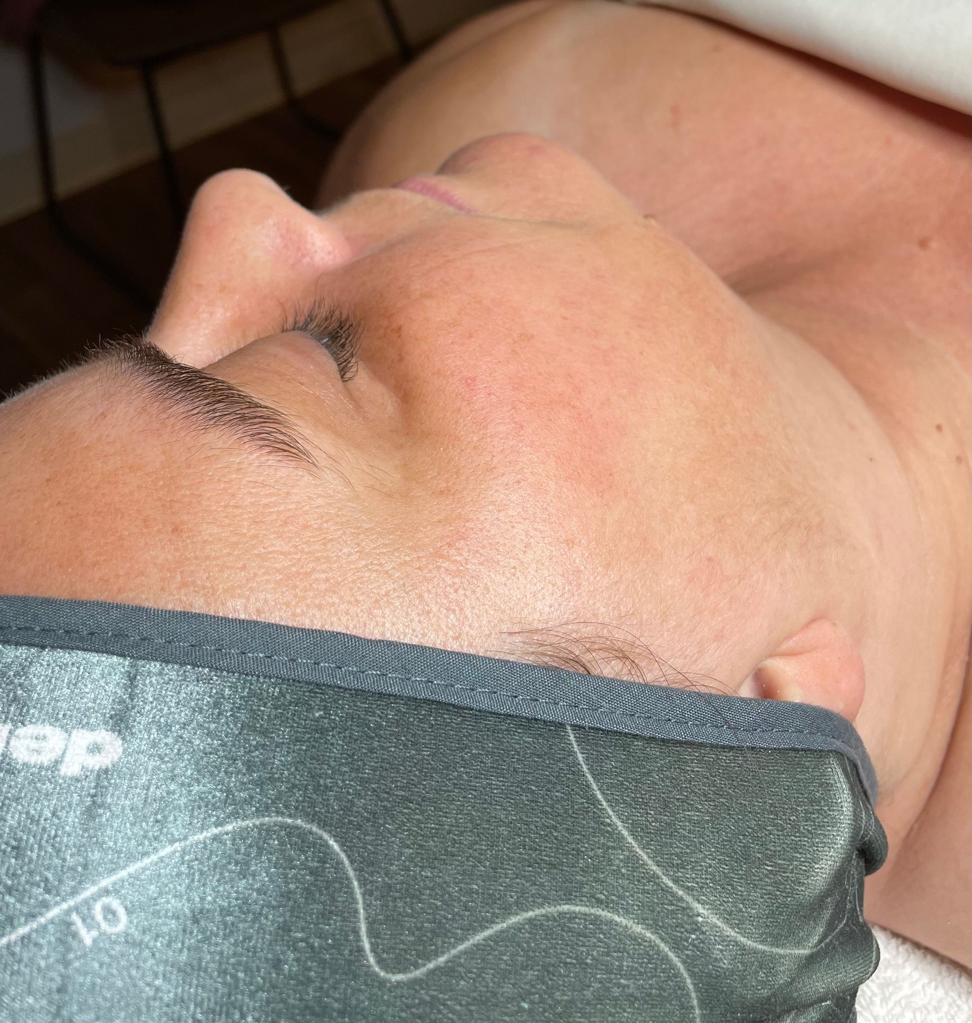 before & after facial