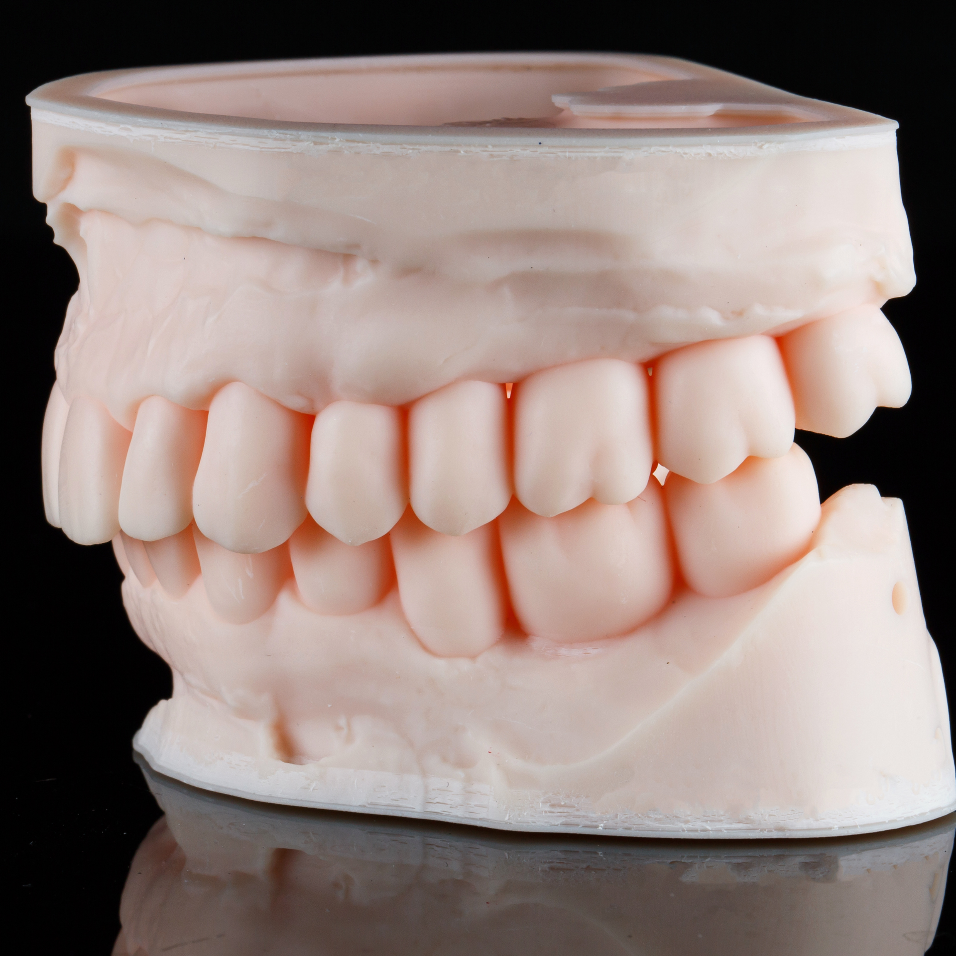Our CAD/CAM technology ultilizes the extreme accuracy of 3D printed models to perfectly contour and finish high aesthetic restorations.