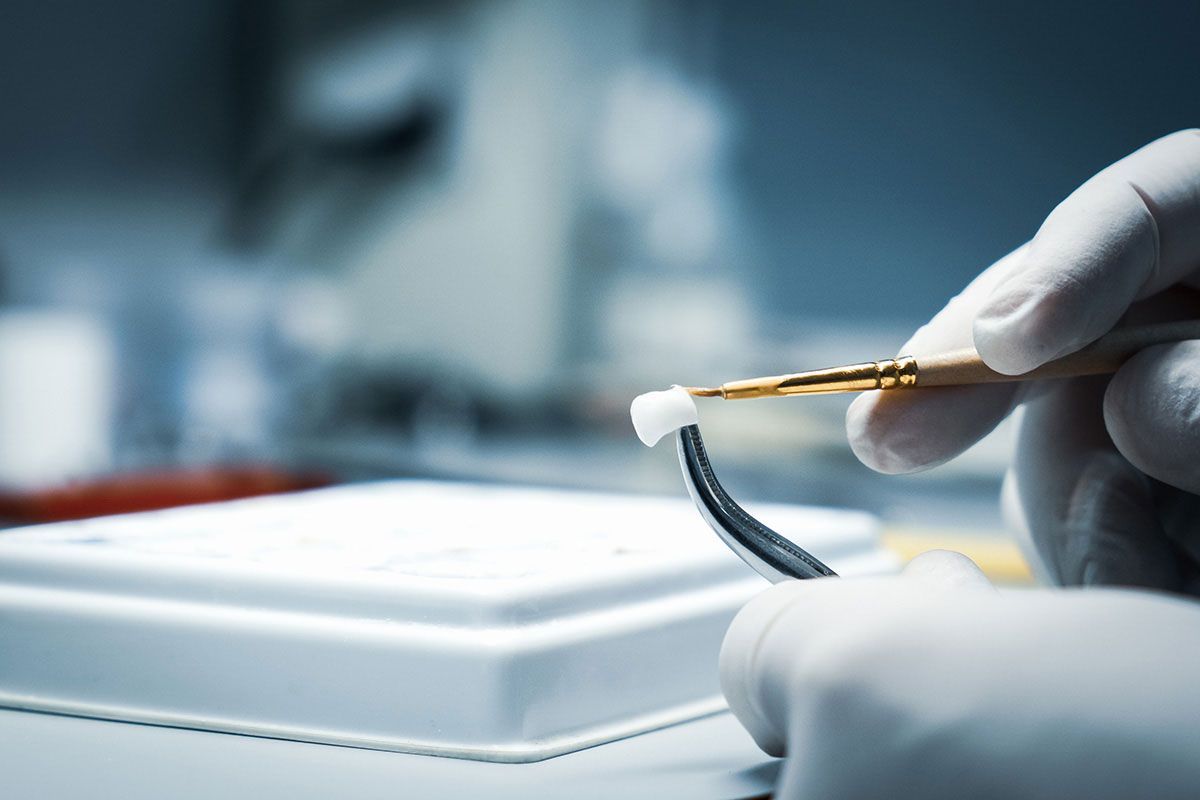 Crown After Root Canal In Tampa: Why The Final Restoration Matters