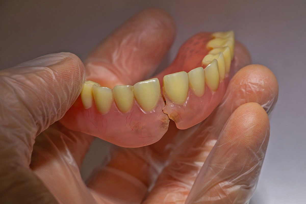 Partial Denture Care In Tampa: Daily Habits That Protect Your Smile And Appliance