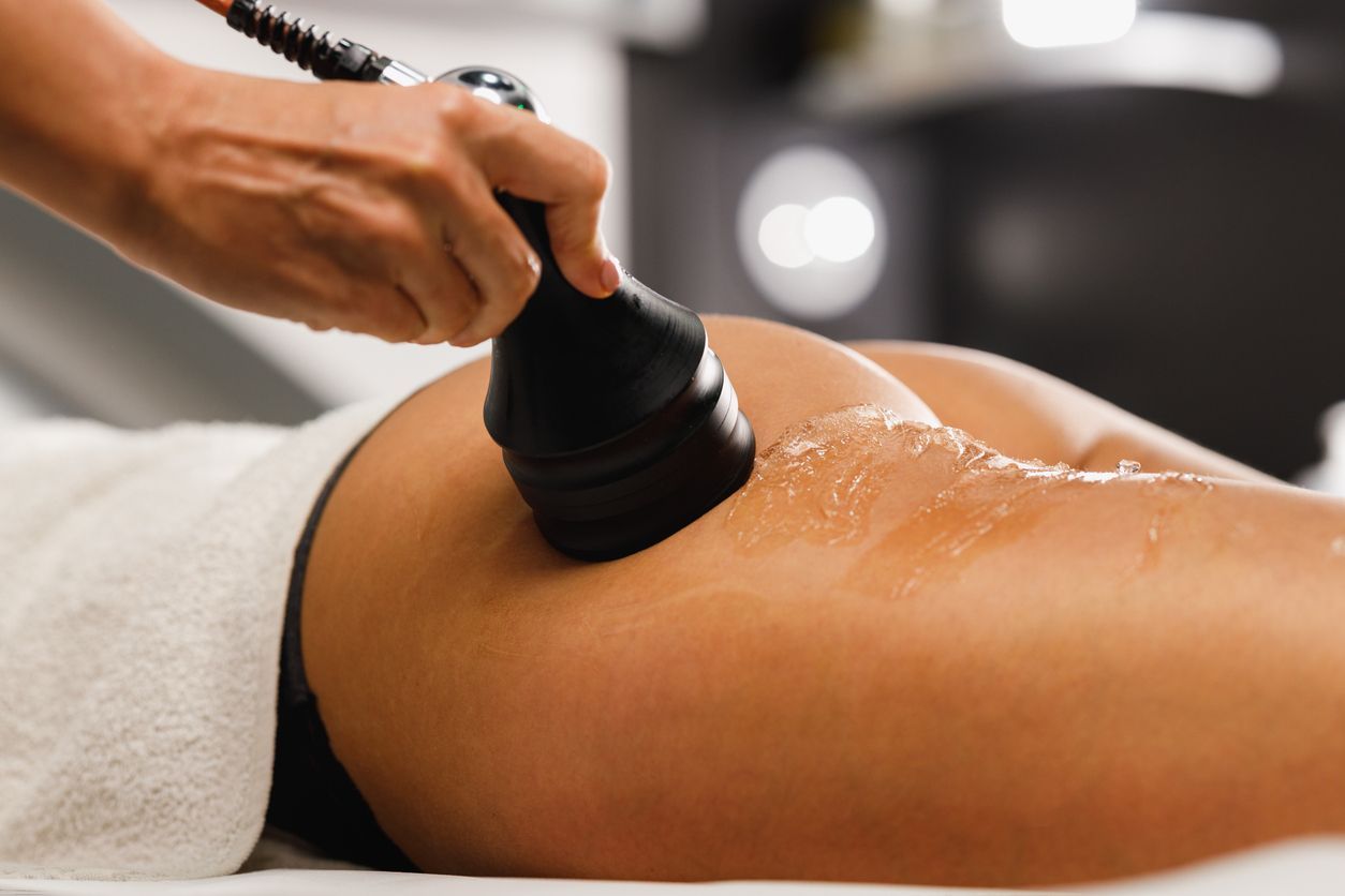 A person’s hand uses a handheld cosmetic device to apply a treatment to a person's thigh and buttocks.