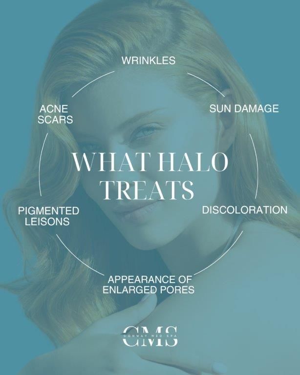 Infographic listing skin conditions Halo treats: wrinkles, sun damage, discoloration, enlarged pores, and acne scars.