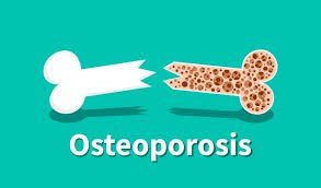 Click here for more information on Osteoporosis from the NHS website Exercise and Osteoporosis