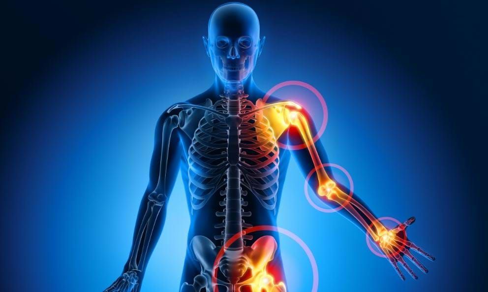 Can you do Fitness PILATES if you have Osteoarthritis?