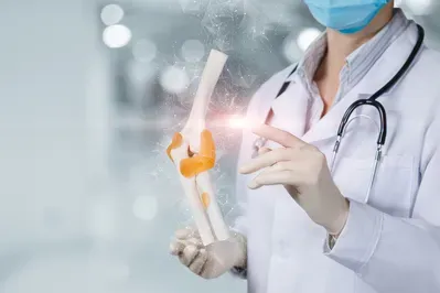 A doctor is holding a model of a knee joint.