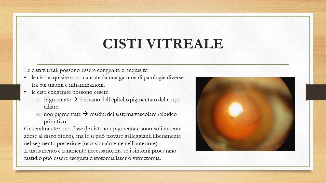 oculista, corsano, carucci, oculista carucci
