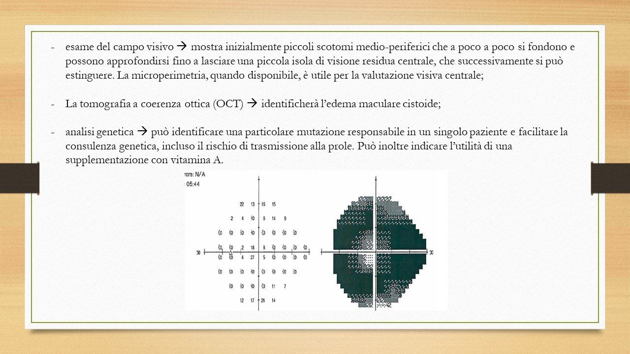 oculista, corsano, carucci, oculista carucci